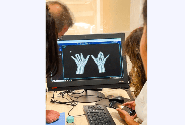 35ª Campaña gratuita del Programa Manitos: cirugías que transforman vidas en Santa Cruz